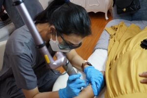 Ramai-ramai Hapus Tato Permanen di MS Glow Aesthetic Clinic Bekasi ⁣