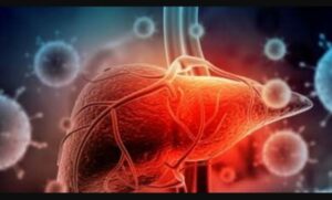 Soal Hepatitis Akut, Ini Pesan IDAI