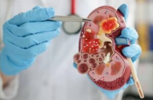 Distributor di Depok Ini Diduga Oplos Cemaran EG, Polisi Periksa Ayah dan Anak Pemilik CV