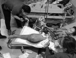 Dibully, Kaki Siswa Diamputasi