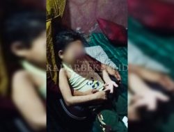 Asyifa akan Operasi setelah Tumor Jinak   