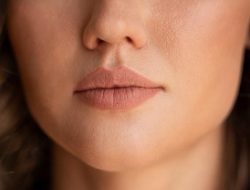 5 Cara Mencegah Bibir Kering dan Pecah-Pecah