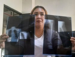 Kasus Perundungan Siswa SDN di Pondokgede Dilaporkan ke Polres