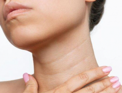 7 Cara Ampuh Memutihkan Kulit Leher, dari Bahan Alami hingga Terapi Medis