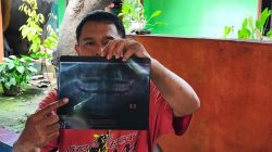 Keluarga Korban Kasus Perundungan Pelajar SMKN di Cikarang Barat Tolak Diversi