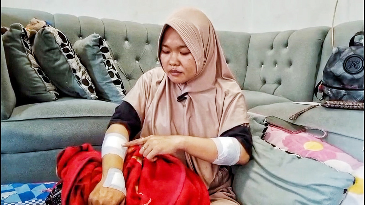 Guru SD Jadi Korban Begal di Cibitung: Motor Raib, Alami Luka Robek 30 Jahitan