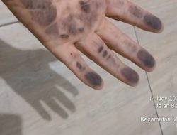 Debu Hitam Menyergap Pejuang Kota Bekasi, Asap Industri Diduga Penyebab