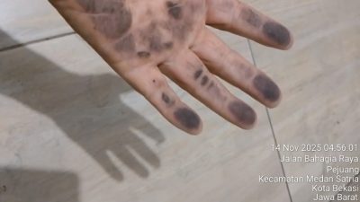 Debu Hitam Menyergap Pejuang Kota Bekasi, Asap Industri Diduga Penyebab