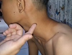 Pelajar Bekasi Korban Dugaan Pengeroyokan Alami Trauma