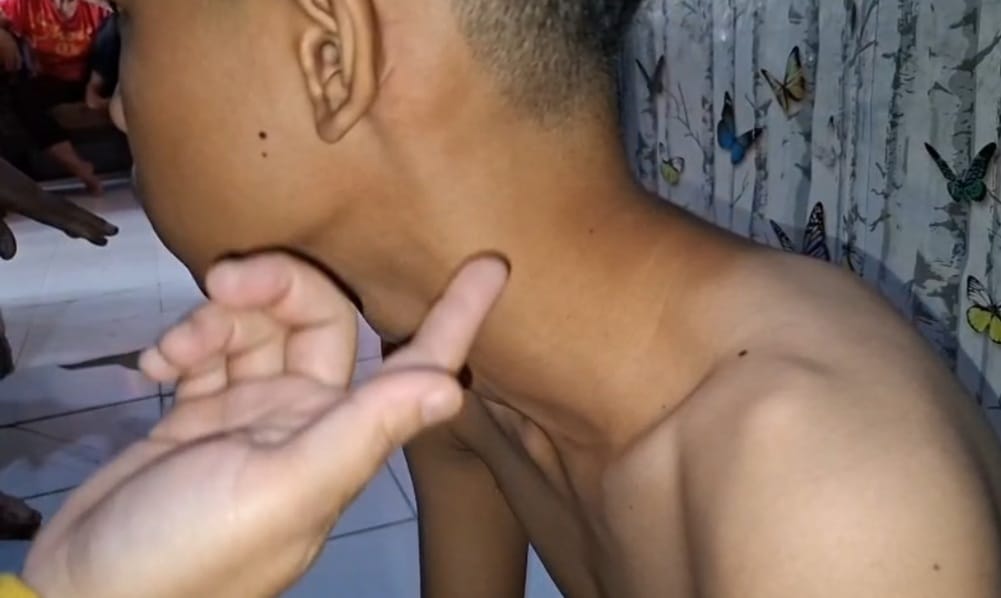 Pelajar Bekasi Diduga Dikeroyok dan Diancam Dibunuh Gegara Cemburu di Medsos