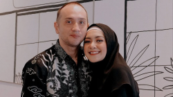 Kesehatan Gary Iskak Sebelum Meninggal Dunia Dibongkar Sang Istri: Sudah Level Akut