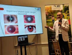 Pahami dan Kenali Risiko Penyakit Glaukoma yang Menjadi Faktor Pemicu Kebutaan