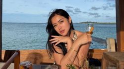 Jessica Iskandar Kena Hepatitis A, Sebut Karyawan Baru Diduga Jadi Pemicunya!