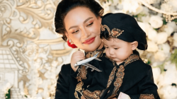 Erika Carlina Langsung Bawa Enduw ke Dokter Usai Dibilang Juling, Begini Hasilnya!