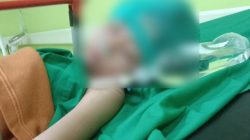 Bocah Korban Dugaan Peluru Nyasar di Setu Kembali ke Rumah, Keluarga Masih Urus Bantuan