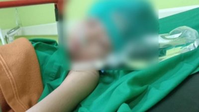 Bocah Korban Dugaan Peluru Nyasar di Setu Kembali ke Rumah, Keluarga Masih Urus Bantuan