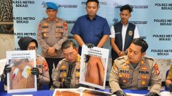 Balita di Tarumajaya Diduga Alami Kekerasan oleh Ibu Tiri, Polisi: Korban Masih Koma