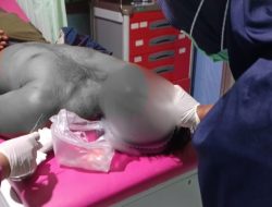 Gara-gara Cekcok di Parkiran Resepsi Pernikahan, Pemuda di Cabangbungin Dihantam Batu